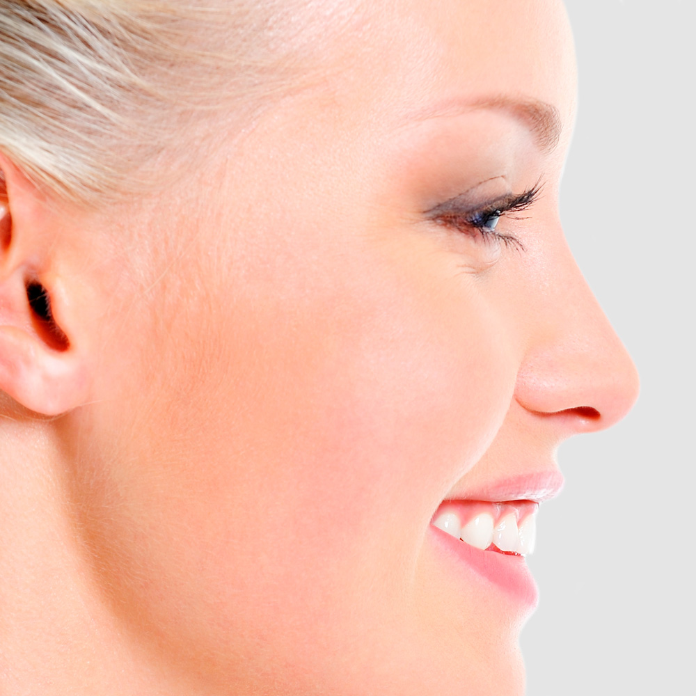 Rinomodelación sin cirugía